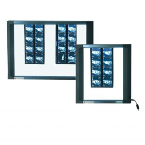 Négatoscope / échelle d’acuité visuelle